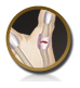 Sprained Thumb