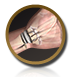 Wrist Joint Replacement (Arthroplasty)